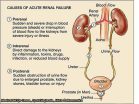 Causes of Acute Renal Failure