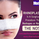 Medspa Cosmetic Surgery Clinic