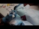 Pediatric Lumbar Puncture- Septic Work Up I