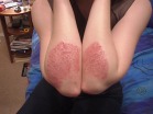 What is your SPOT Diagnosis?