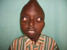 What is your SPOT Diagnosis?