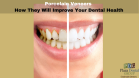 How Porcelain Veneers Improve Your Dental Health