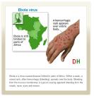 Ebola hemorrhagic rash