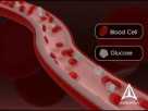 Diabetes Education - 3D Medical Animation