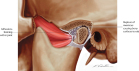 Temporamdibular Arthrosis