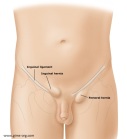 Groin hernias