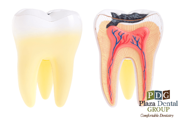 How to avoid tooth decay