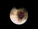 MAGGOTS IN EAR.flv