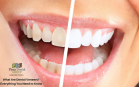 Porcelain Veneers Can Improve Your Smile