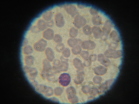 Basophil