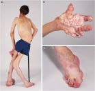 What is your SPOT Diagnosis?