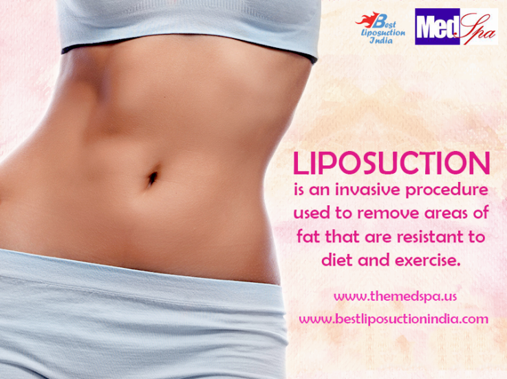 Who is a good candidate for liposuction?