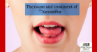 Tips of controlling xerostomia