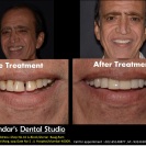 Digital Smile Design